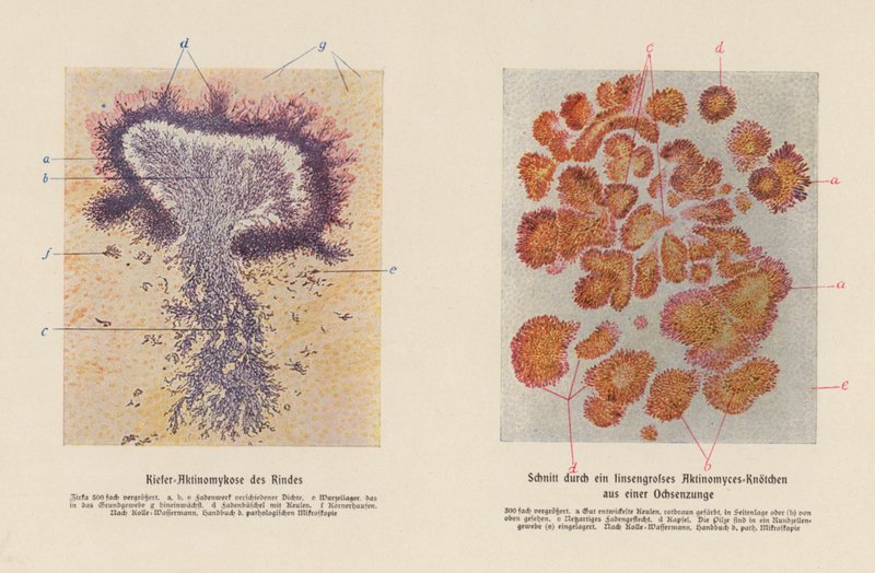 Actinomyces bovis (farvelitografi) af German School