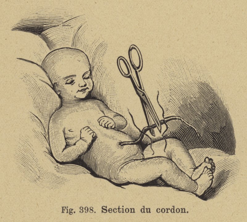 Klipning af en nyfødt babys navlestreng af German School