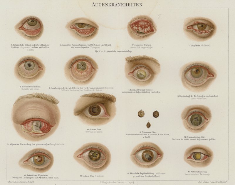Øjenlidelser (farve litho) af German School