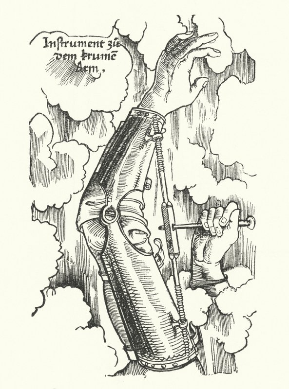 Instrument til behandling af en såret arm (gravering) af German School