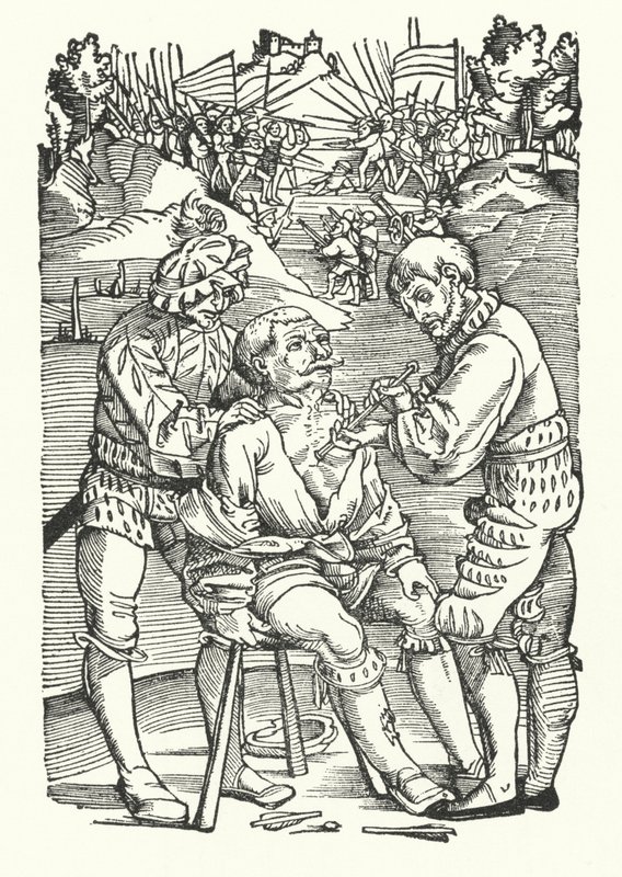 Behandling af en såret soldat på slagmarken (gravering) af German School