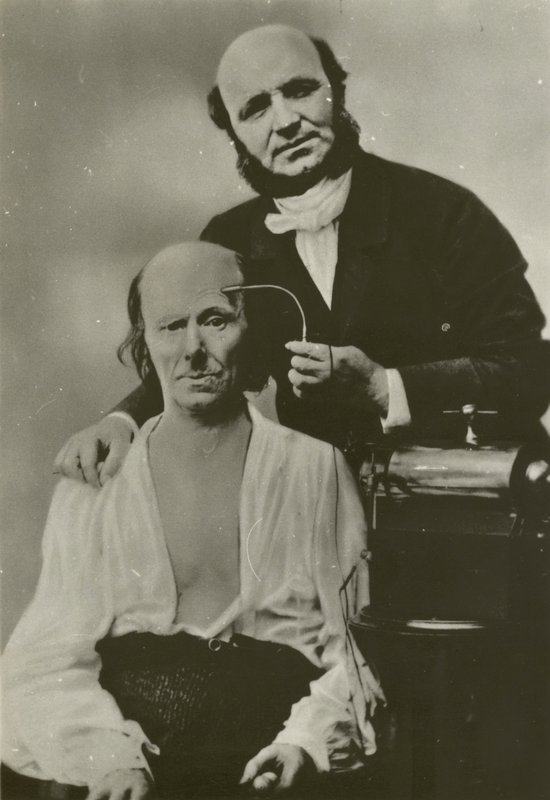 Den franske neurolog Duchenne de Boulogne bruger sit elektrofysiologiske apparat på en gammel mand af Guillaume Benjamin Armand Duchenne de Boulogne