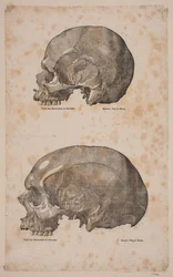 The Cranier