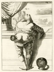 Et eksempel på cupping, fra The Practice of Medicine af Frederik Dekkers, 1694