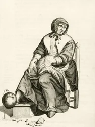 Using a Mechanical Leech, from Practical Exercises about the Method of Healing af Frederik Dekkers, 1694