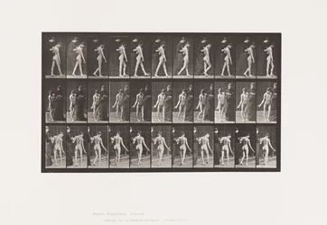 Plade 541. Multipel Cerebro-Spinal Sklerose (Choreic); Gåture