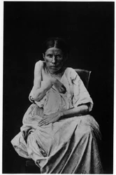 Fotografi af en patient, der lider af hemiplegisk epilepsi, -i "" fotografisk ikonografi af Salpetrière, Bourneville og P. Regnard, Paris