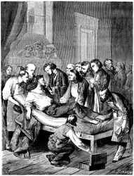 Første kirurgiske operation med svovlsyre-etherbedøvelse på Boston Hospital, udført den 16. oktober