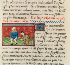 Ms 22532 Undersøgelse af en patient med hæmorider, fra Le Livre des Proprietes des Choses af Barthelemy lAnglais, ca. 1410-15