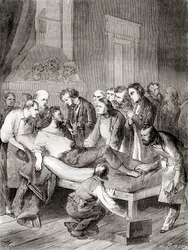Den første offentlige demonstration af brugen af inhaleret ether som et kirurgisk bedøvelsesmiddel i 1846 af en amerikansk tandlæge, William Thomas Green Morton, fra 