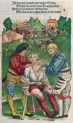 Fjernelse af en pil, illustration fra Feldtbuch der Wundartzney af Hans von Gersdorff, 1540