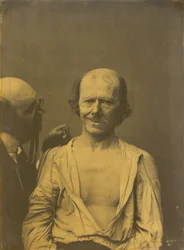 Et afslappet ansigt (til venstre); falsk glæde eller latter (til højre),1854-1856, trykt 1862 (foto)