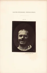 Fotografisk elektrofysiologi, figur 53