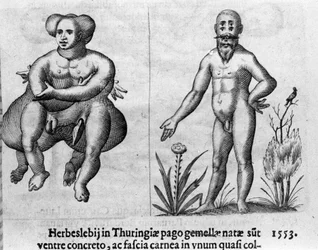 Forskellige typer menneskelige monstre. Indgravering fra "Monstrenes natur, årsager og forskelle" af Fortunio Liceti (1577-1656), italiensk videnskabsmand. 1646