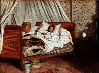 Den improviserede ambulance (Claude Monet såret). Maleri af Jean Frédéric Bazille (1841-1870)