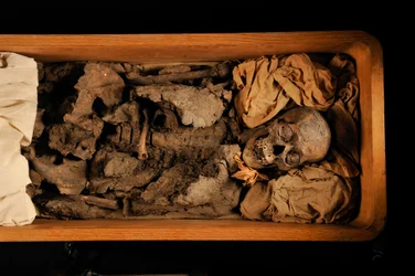 mm7864; Tutankhamon; 18. dynasti; Det Nye Rige; Det Egyptiske Museum; Cairo; DNA; samp..., 2005 (foto)