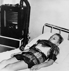 Elleve år gammel dreng i en jernlunge, Beaujon Hospital, Paris, c1947-1951