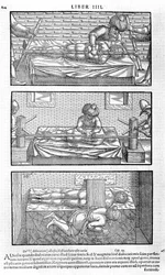 Illustration fra Avicenna, 1556