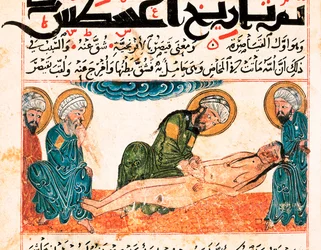 Repræsentation af kejsersnit. Miniature taget fra et manuskript af medicin af Abu Raihan Al-Biruni (eller Alberuni) (973-1048), persisk intellektuel og videnskabsmand, folio 161.