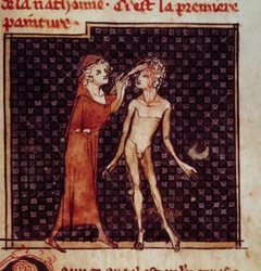 Anatomisk figur: Kirurgen skærer ind i en patients pande. Miniature fra manuskriptet "" Surgery" (Folio 8) skrevet af Henri de Mondeville (kirurg hos Philippe Le Bel professor i anatomi)