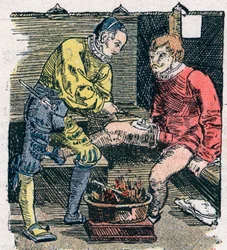 Kirurg giver et sår i 1528.
