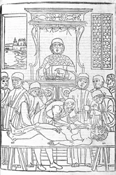 Anatomisk dissektion. Gravering fra en afhandling om medicin af Gerolamo Cardano (Cardanus Hieronymus), Firenze