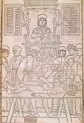 Obduktion. Codice. Liget af en død mand dissekeres af læger til en anatomiundersøgelse. “” Fasciculus Medicinae””. Codex af en læges fascicle af Johannes Kethan