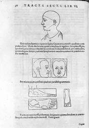 Billede af fysiognomi fra "Collection of Works"" af Robert Fludd (Robertus de Fluctibus). London 1617