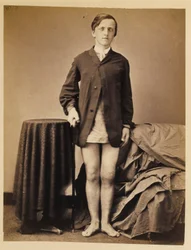Menig G. W. Warrington, helbredelse uden amputation efter skudbrud på højre knæskal, fra den kirurgiske afdelings fotografiske katalog